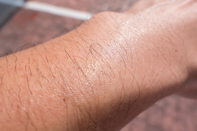 25岁的我雪白皮肤上长了黑色体毛,婆婆嫌弃我败坏家风不良少女