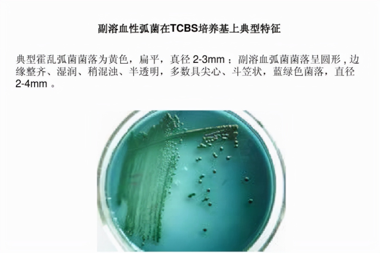 食源性过敏原,食源性致病菌引发的国际案例