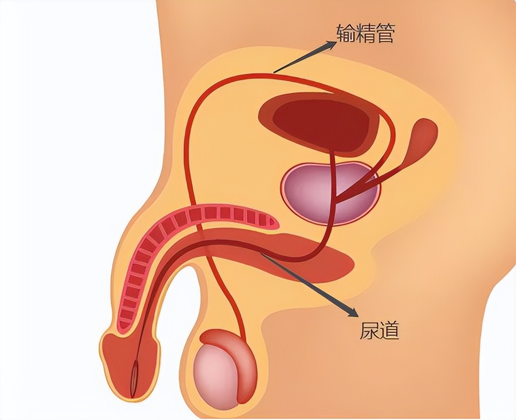 夫妻生活过程中，男人尿尿和射精会同时发生吗？医生为你解答