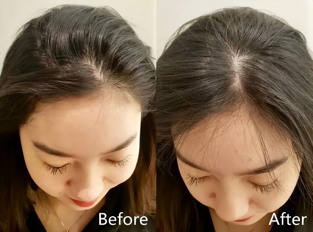 洗完头头发干燥怎么办,洗完头如何让头发蓬松又好看