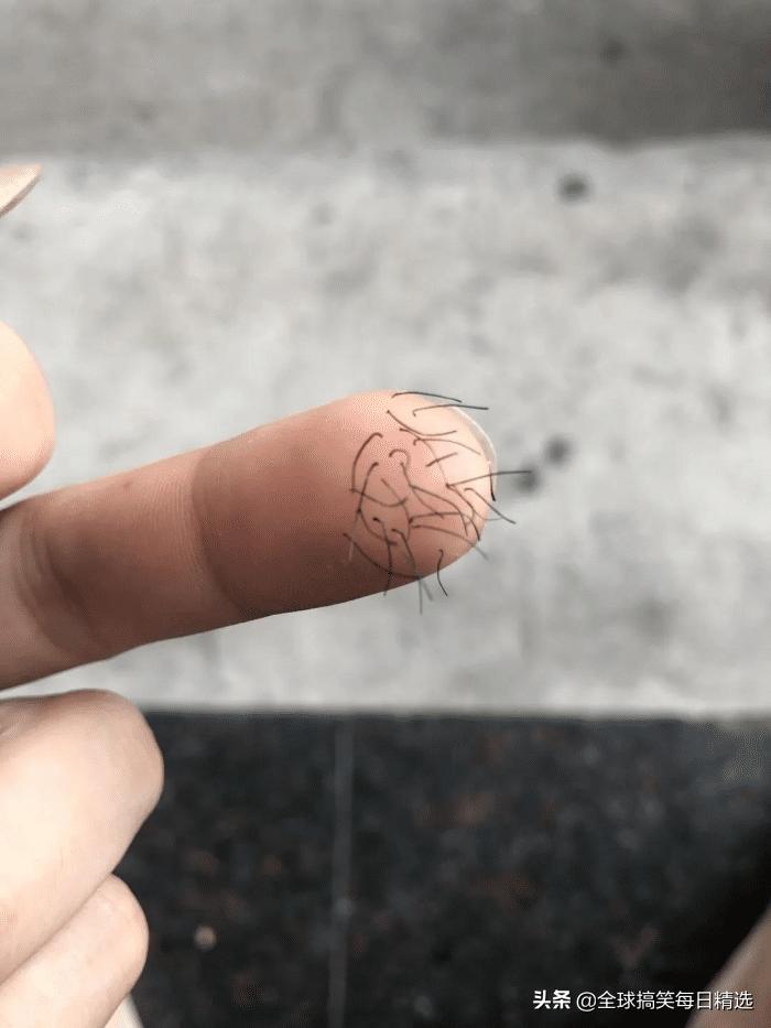 爬山回来为什么手指头长毛,爬山回来手指头长了几根毛