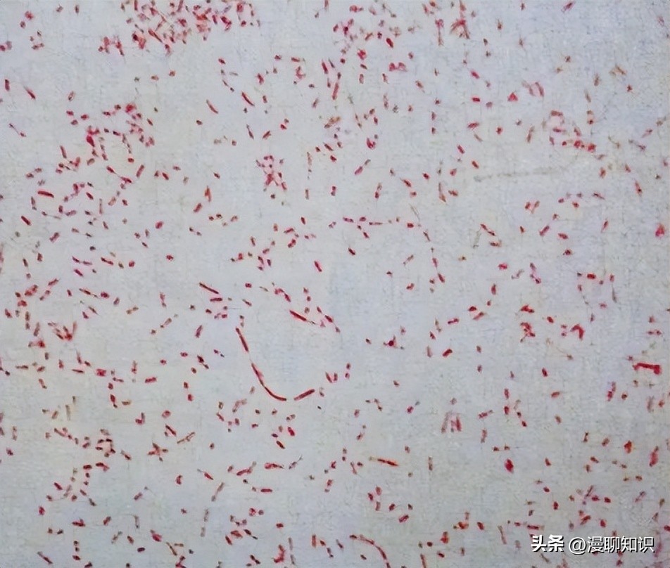 副猪嗜血杆菌是一种巴氏杆菌，其生长依赖于V因子，还有其他的吗