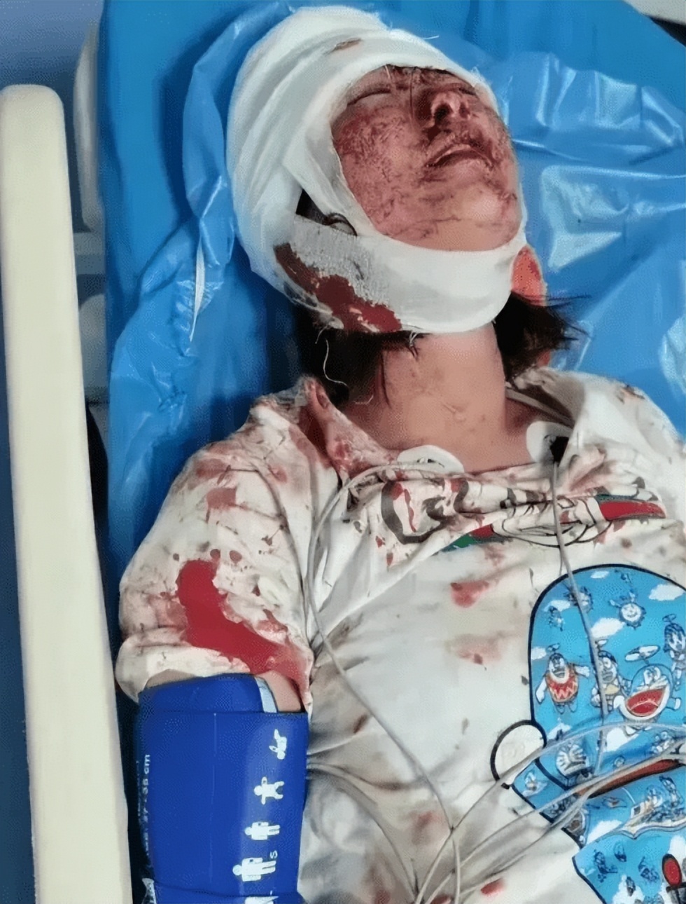 好事不出门，坏事传全球，超20国媒体报道唐山事件，太丢人