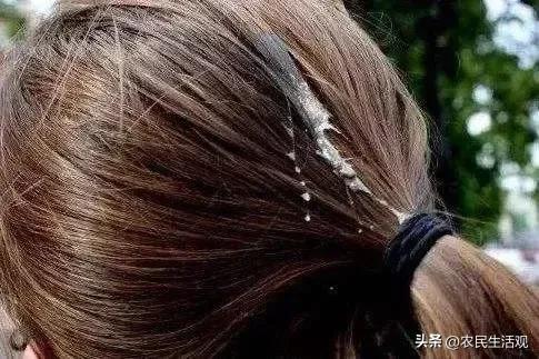 小鸟拉屎到人身上是好还是坏呢,鸟往人身上拉屎是好事还是坏事