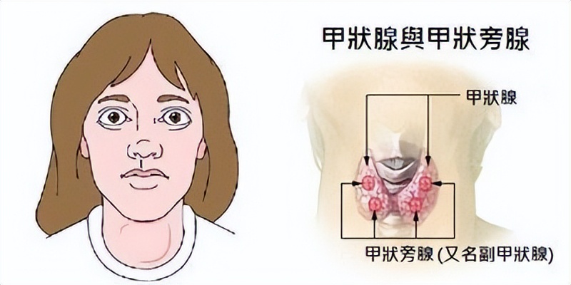 李连杰得甲亢后的照片,李连杰得甲亢前后照片对比