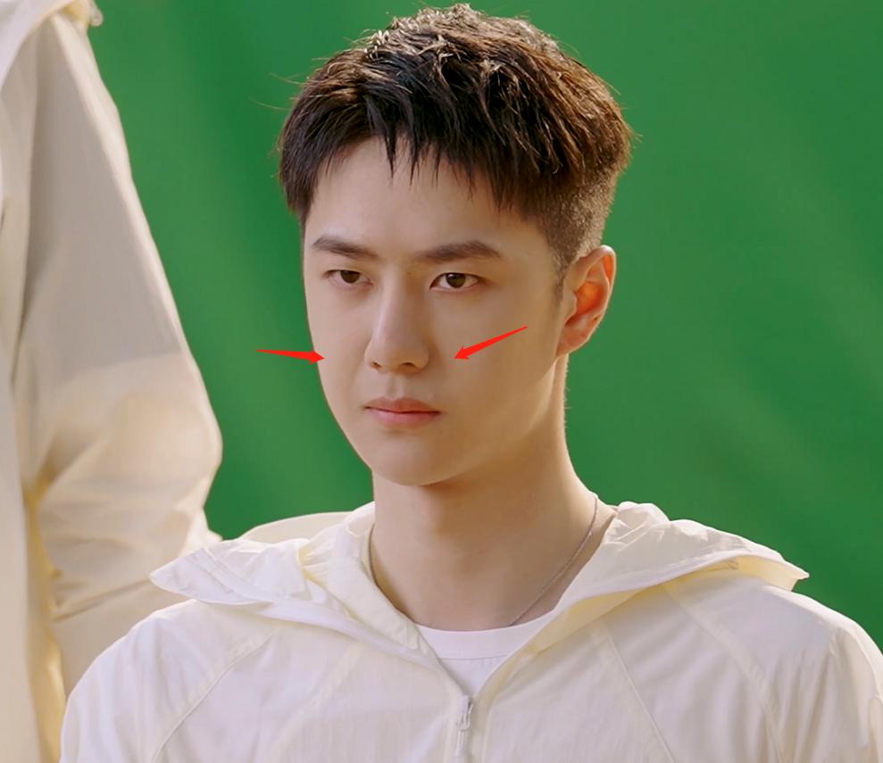 王一博脸型无颧骨,王一博的法令纹