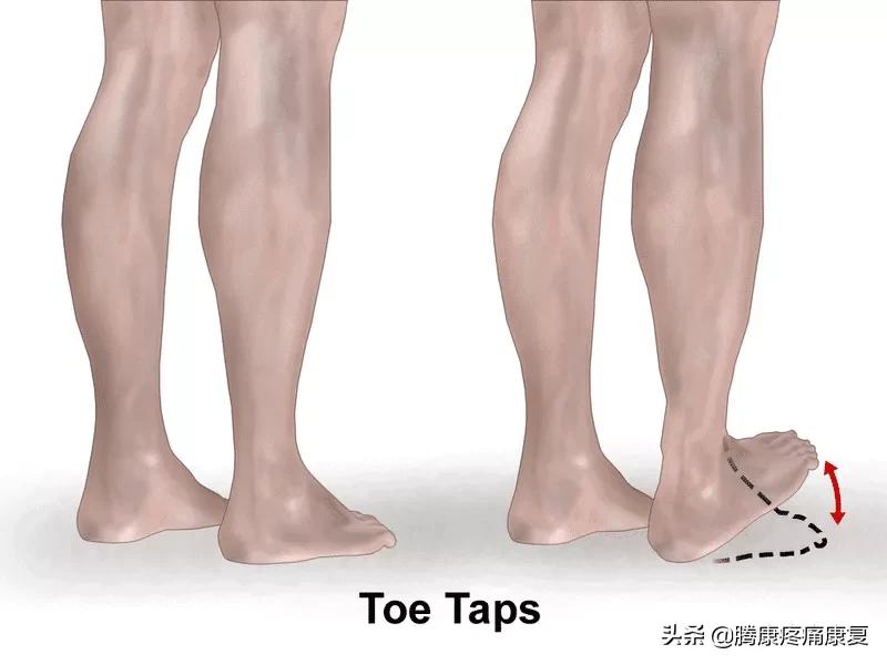 功能性高足弓的练习方式,足弓疼痛3个动作缓解