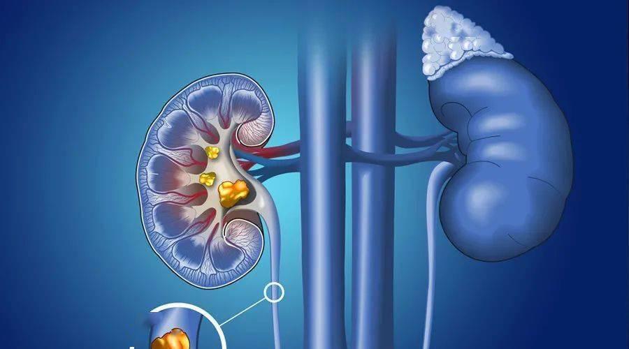 男人身上三处发黑证明肾功能很强,肾功能异常脸色发黑