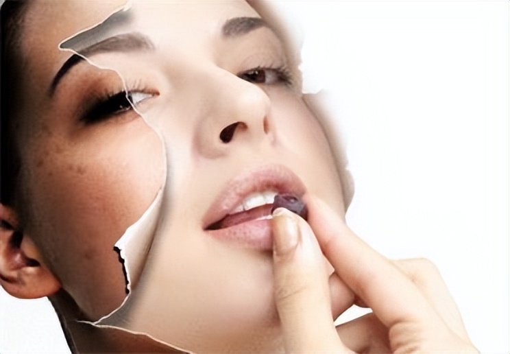 激光祛斑术后注意事项有哪些,皮秒激光祛斑后应该注意事项