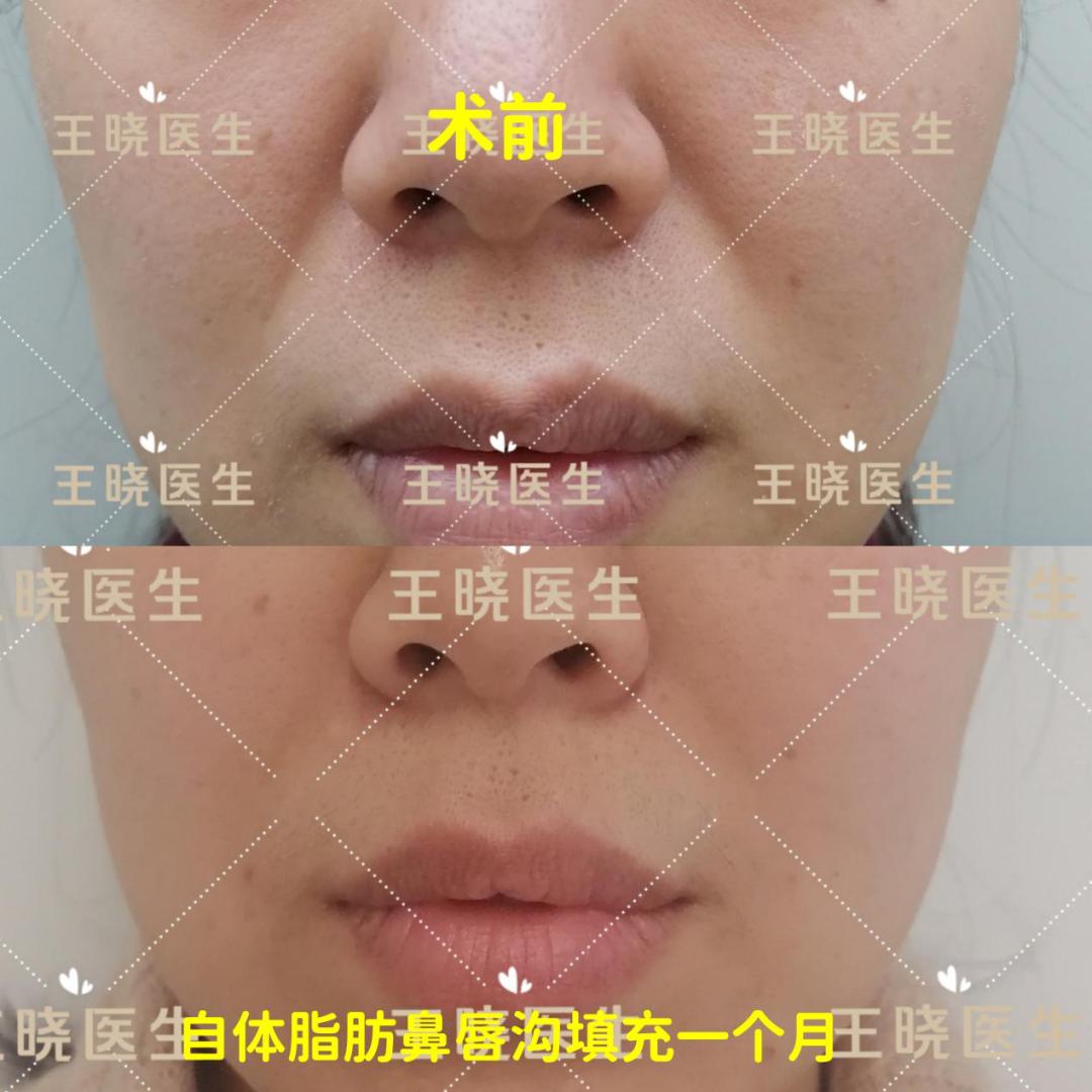 医疗美容变美秘诀,美容科医生教你悄悄变美