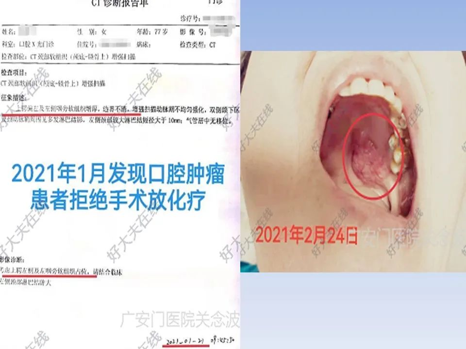 正确使用中医药治疗肿瘤才显效,关于中医中药在肿瘤治疗中的见解