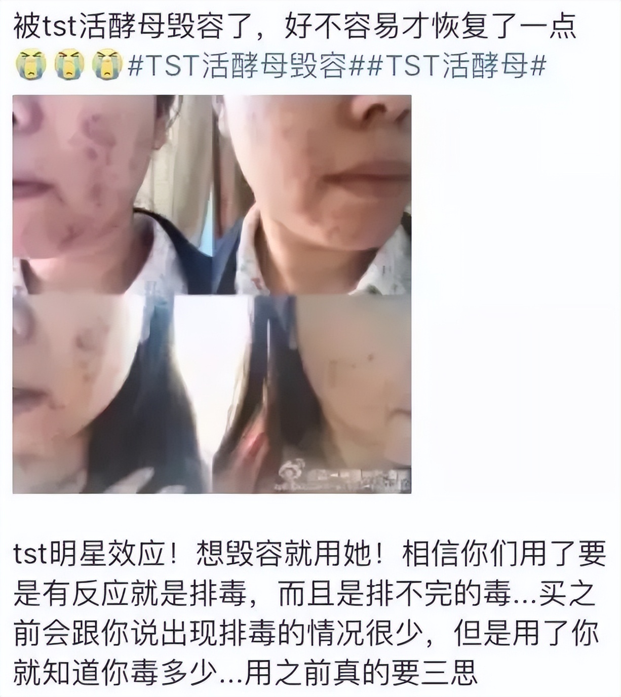 微商张庭现状如何,深度分析张庭微商