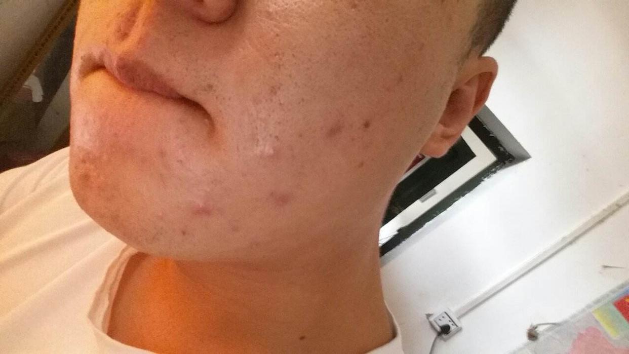 50岁男人为什么会雄激素下降,50岁男性雄性激素旺盛