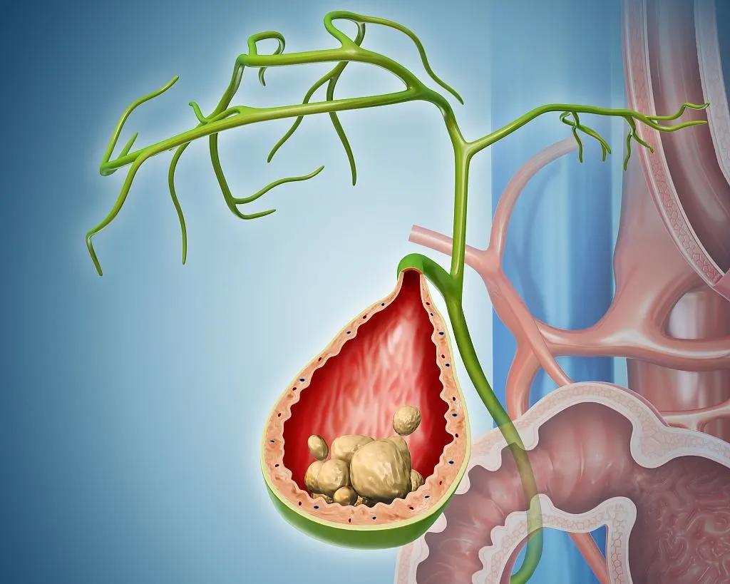 胆结石为什么会在夜间腹胀,胆结石为什么总是晚上发作