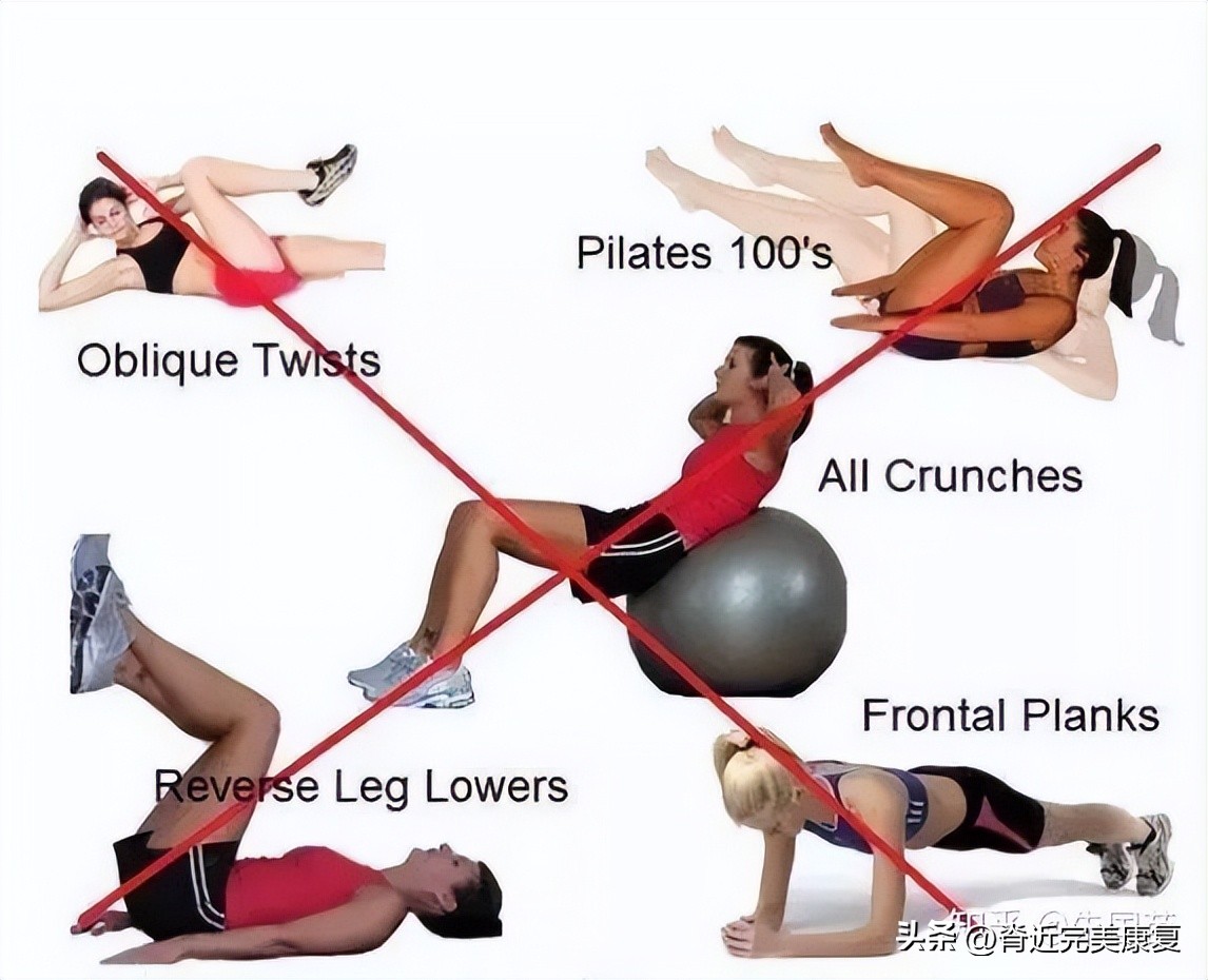 生完孩子后腹直肌一定会分离吗,生完孩子后腹直肌分离是怎么回事