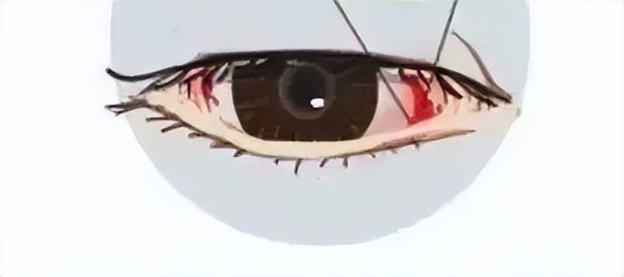 眼角银屑病的症状,眼皮银屑病的症状