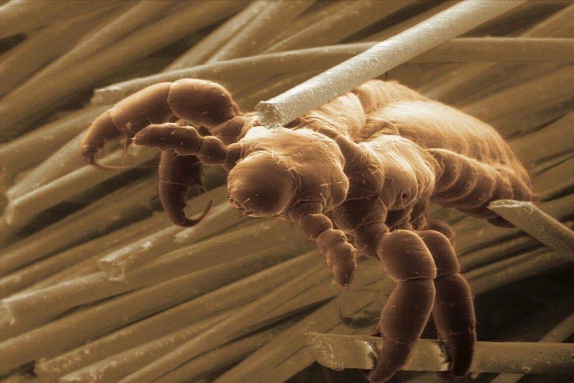 女性的阴毛有哪些用处？刮掉到底好不好？不要害羞，医生做出解释