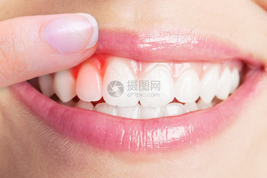 牙龈发炎肿痛怎么办快速止痛,牙龈肿痛很厉害发炎快速止痛方法