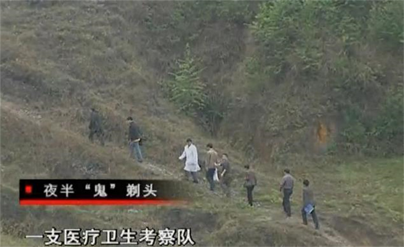 走近科学揭秘鬼剃头,揭秘鬼剃头