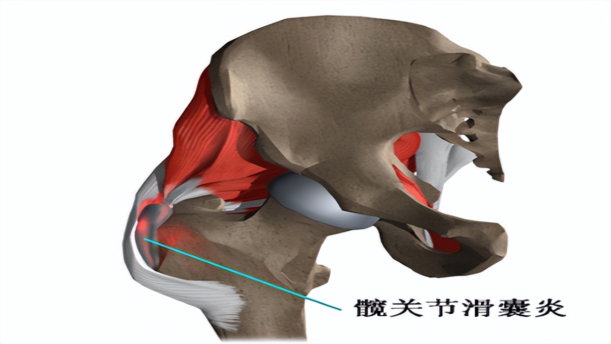 胯骨疼痛要警惕什么病,身体有病情况说明