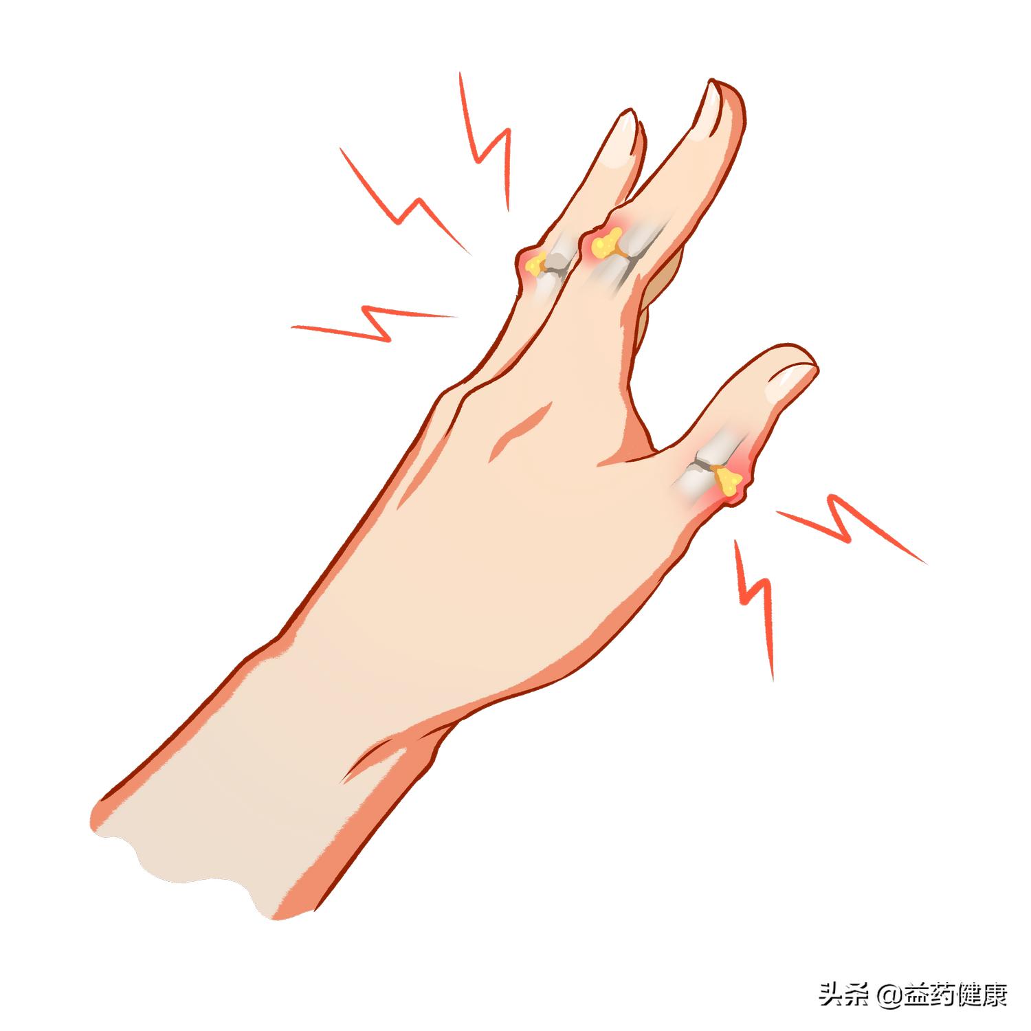 痛风患者吃非布司他记住这4点，掌握用药注意事项，降尿酸更安全