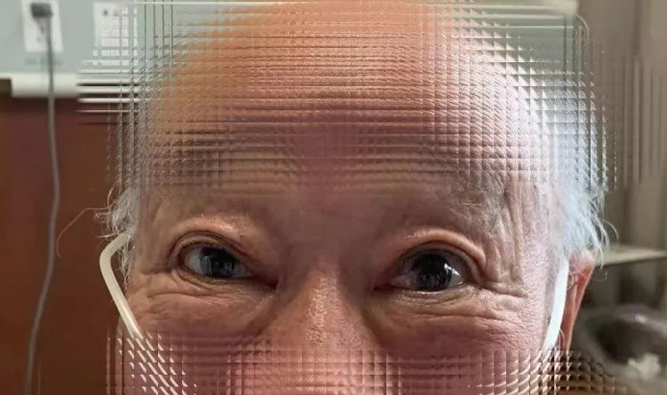 眼皮抬不起来吃什么药,眼皮抬不起来啥病