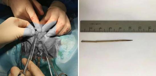 猫咪误食异物呕吐出来就没事了吧,猫咪把喂食软管吃进肚子里了