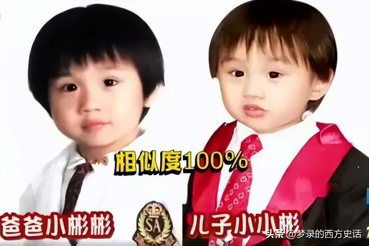 皮肤溃烂的童星,童星打促进生长激素后真实经历