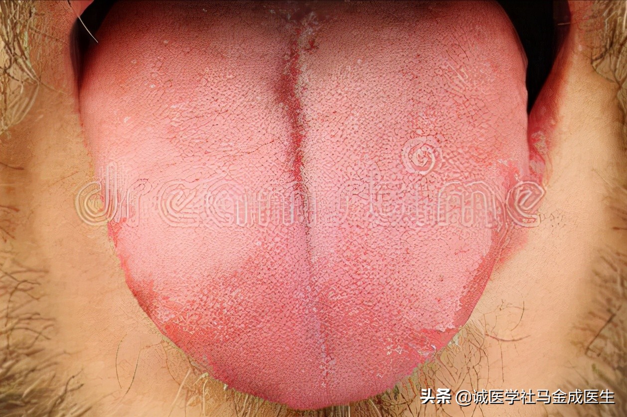 一个方子补阳气，简单3味药，回阳通脉，阳气足了不再冷