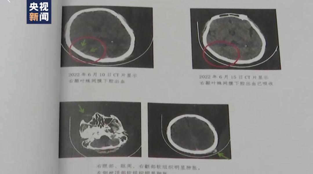 唐山打人事件有关领导会被处分吗,唐山打人事件被免职的领导干部