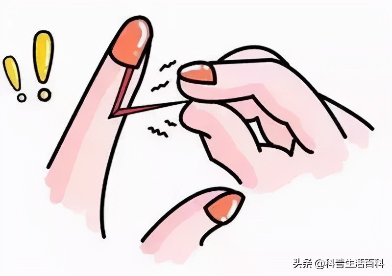 长倒刺说明啥,长倒刺吃什么好