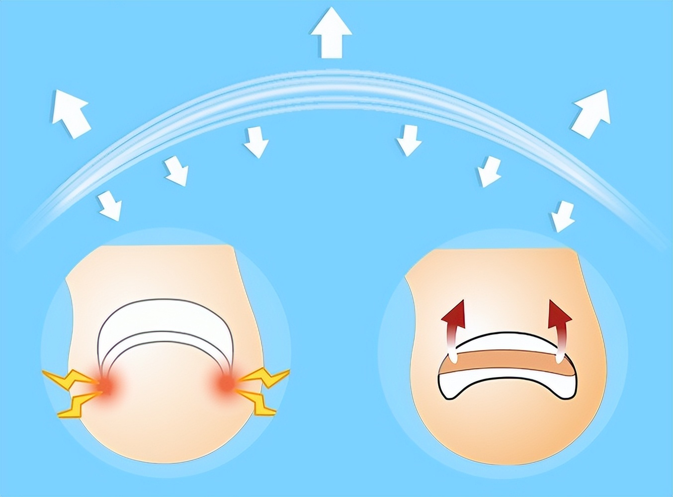甲沟炎痛的无法剪指甲怎么办,甲沟炎清理过了为什么还是痛