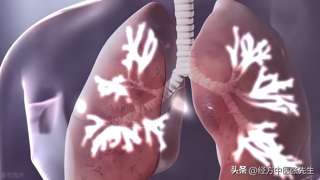 治疗肺气肿肺心病厉害的老中医,肺气肿及肺心病用什么中药