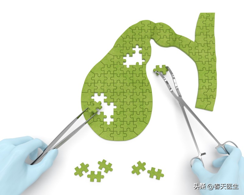 胆结石里面的石头怎么形成的,胆结石疼痛之后没石头了怎么回事