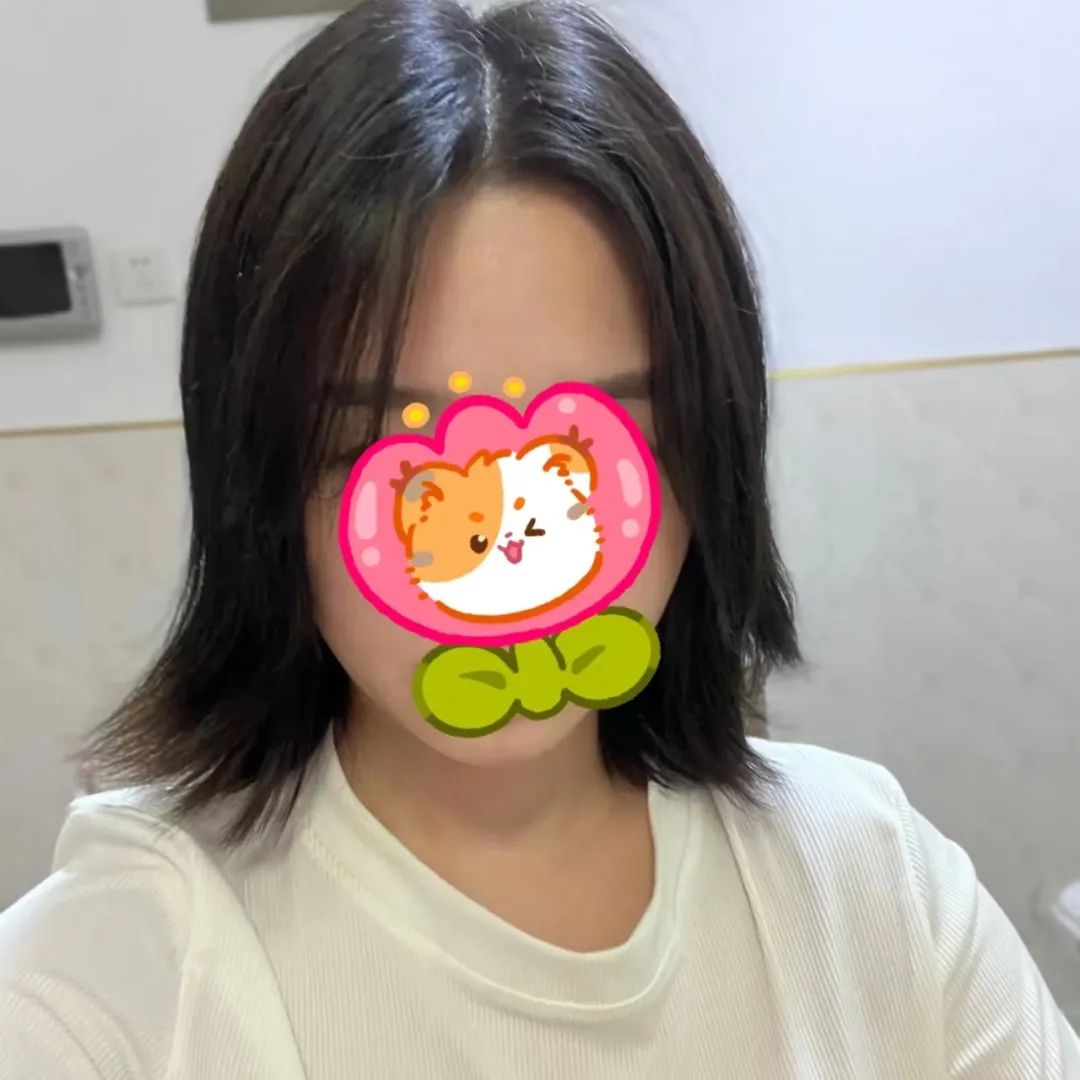 发量少的人建议剪短发吗,为啥医生建议剪短发