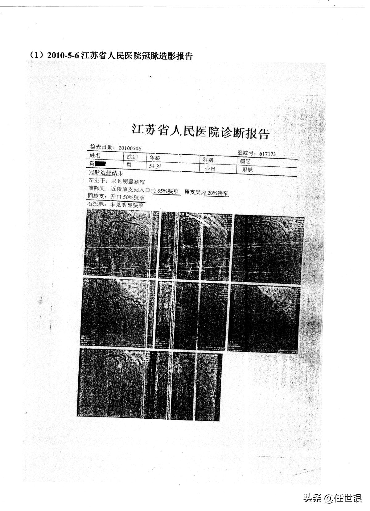 中西医结合怎么治疗冠心病心绞痛,中西医结合治疗冠心病的药物