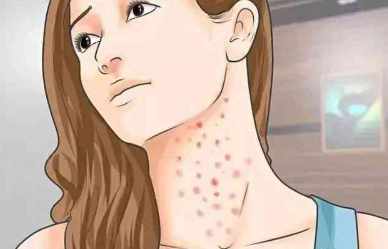 别错把艾滋病当成皮肤病,不要把艾滋病当皮肤病