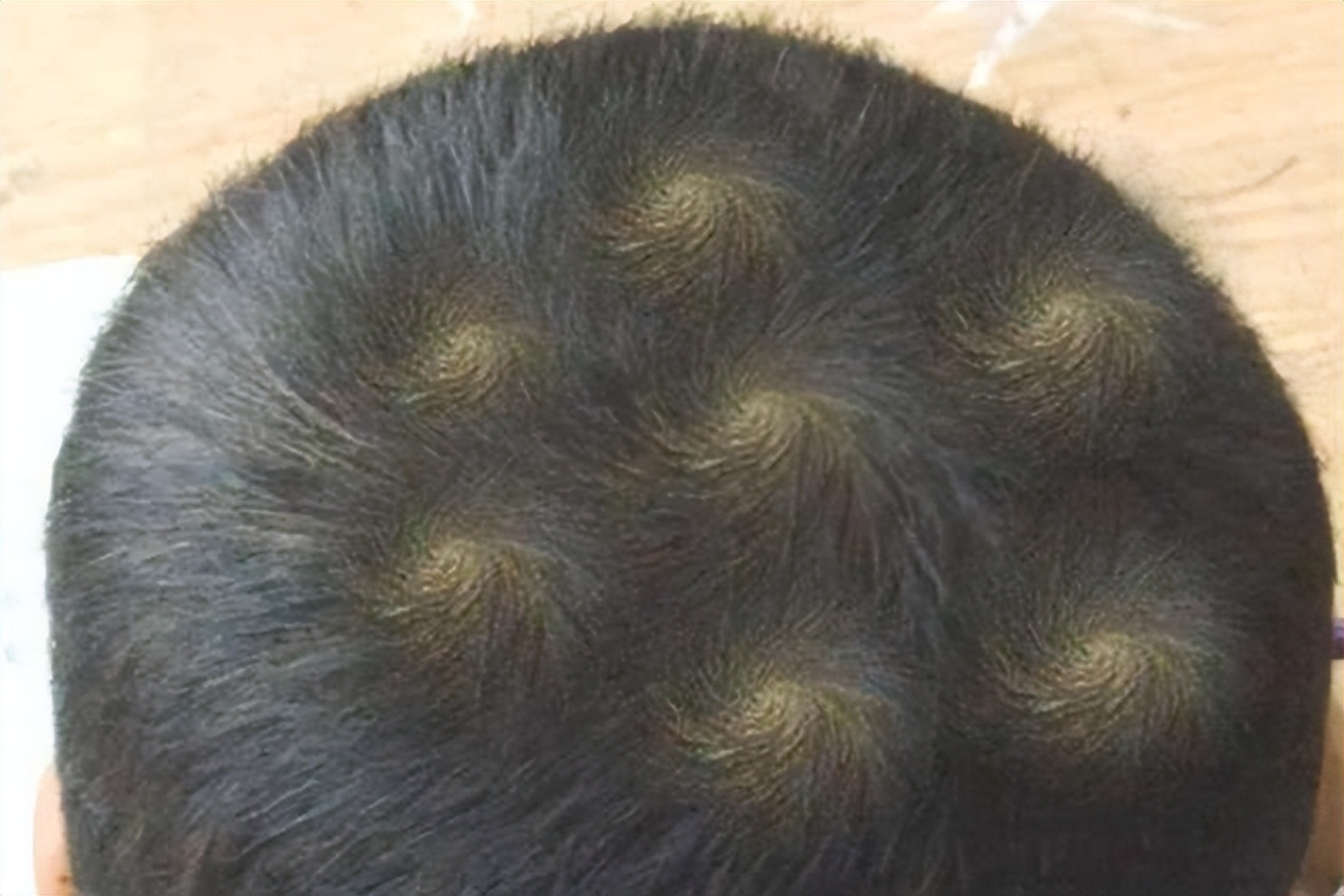 头上有两个旋智商高吗,孩子头上旋的个数暗示孩子智商