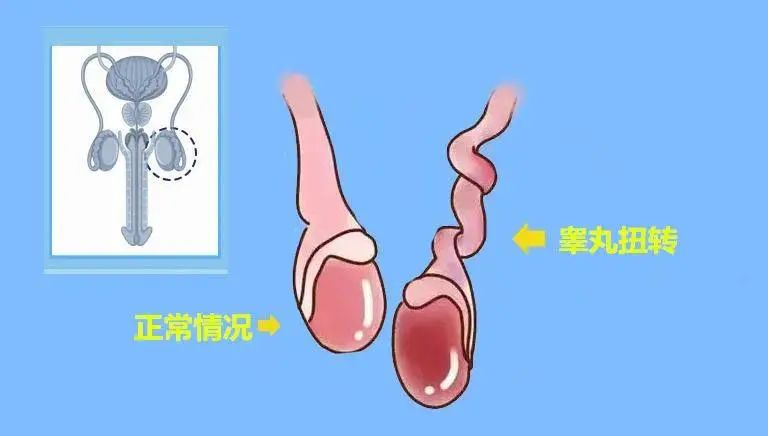 惊险!“蛋疼”千万别忍,13岁男孩“蛋蛋”扭转了360度