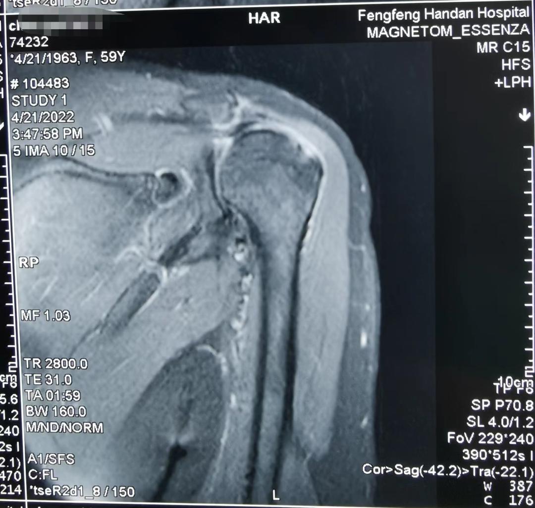 鑲╁叧鑺傚叧鑺傞暅寰垱浜茶韩缁忓巻,鑲╁叧鑺傚叧鑺傞暅瑙嗛