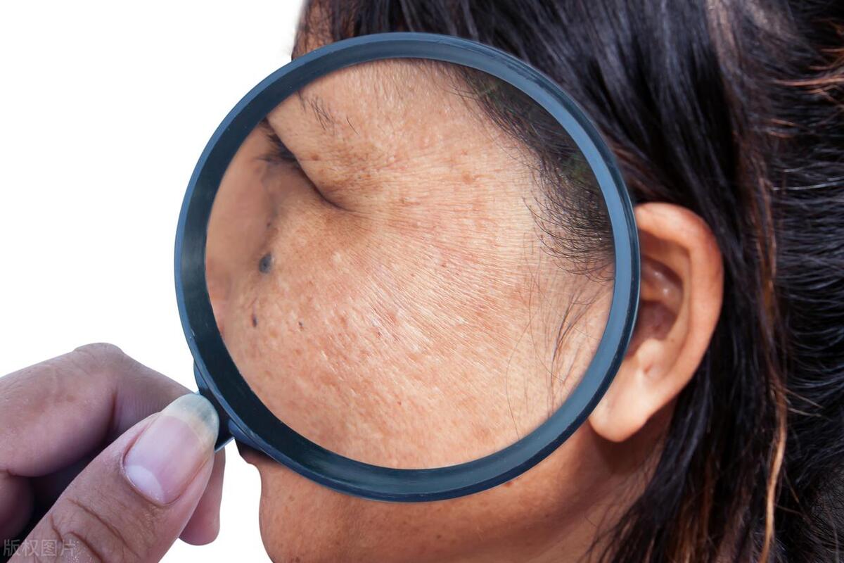 皮肤变得暗黄干燥粗糙怎么调理,皮肤黄暗沉吃什么可以改善