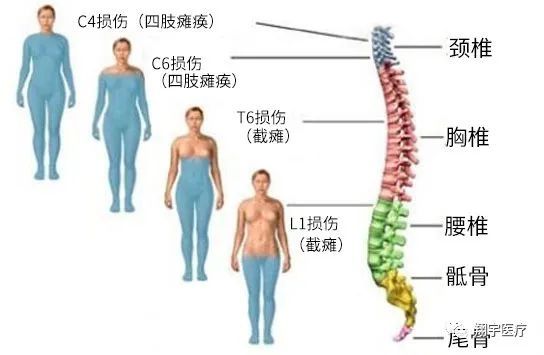 功能性电刺激属于哪类疗法,神经源性肠道功能训练技术
