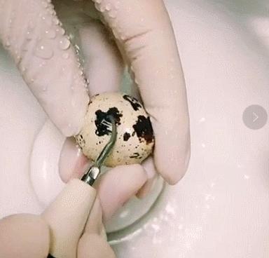 洗牙后觉得牙齿酸软是怎么回事,牙齿酸软适合洗牙吗