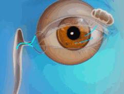 人体解剖尸体怕什么,人体解剖尸体的真相