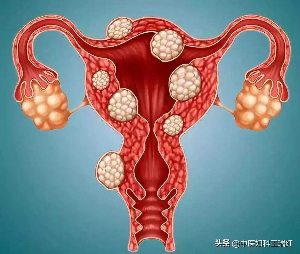 贫血发现肿瘤,贫血多年检查发现隐血