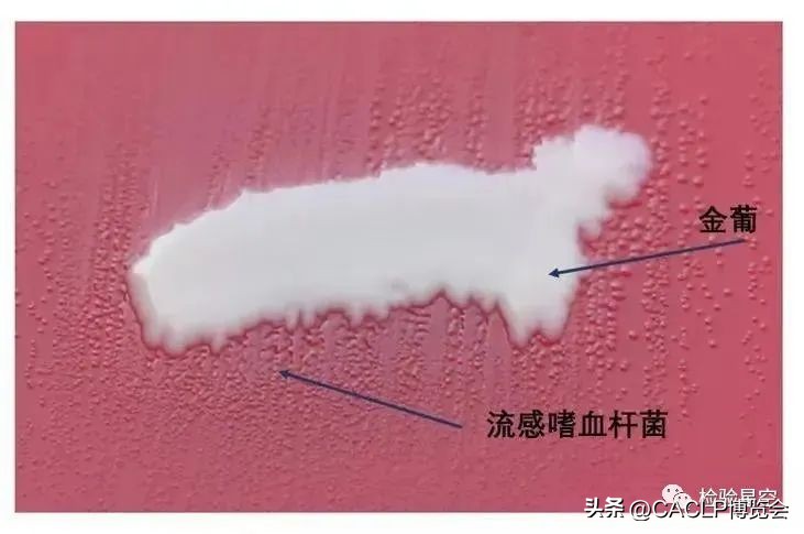 2017版医疗器械分类目录对照表,17年医疗器械分类目录21类