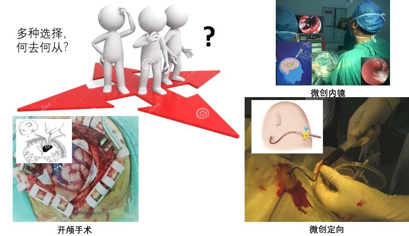 脑出血诊断后，如何处理？