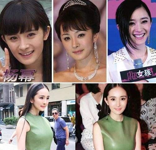 盘点整容失败惨不忍睹的30位女星,那些整容整失败的女明星