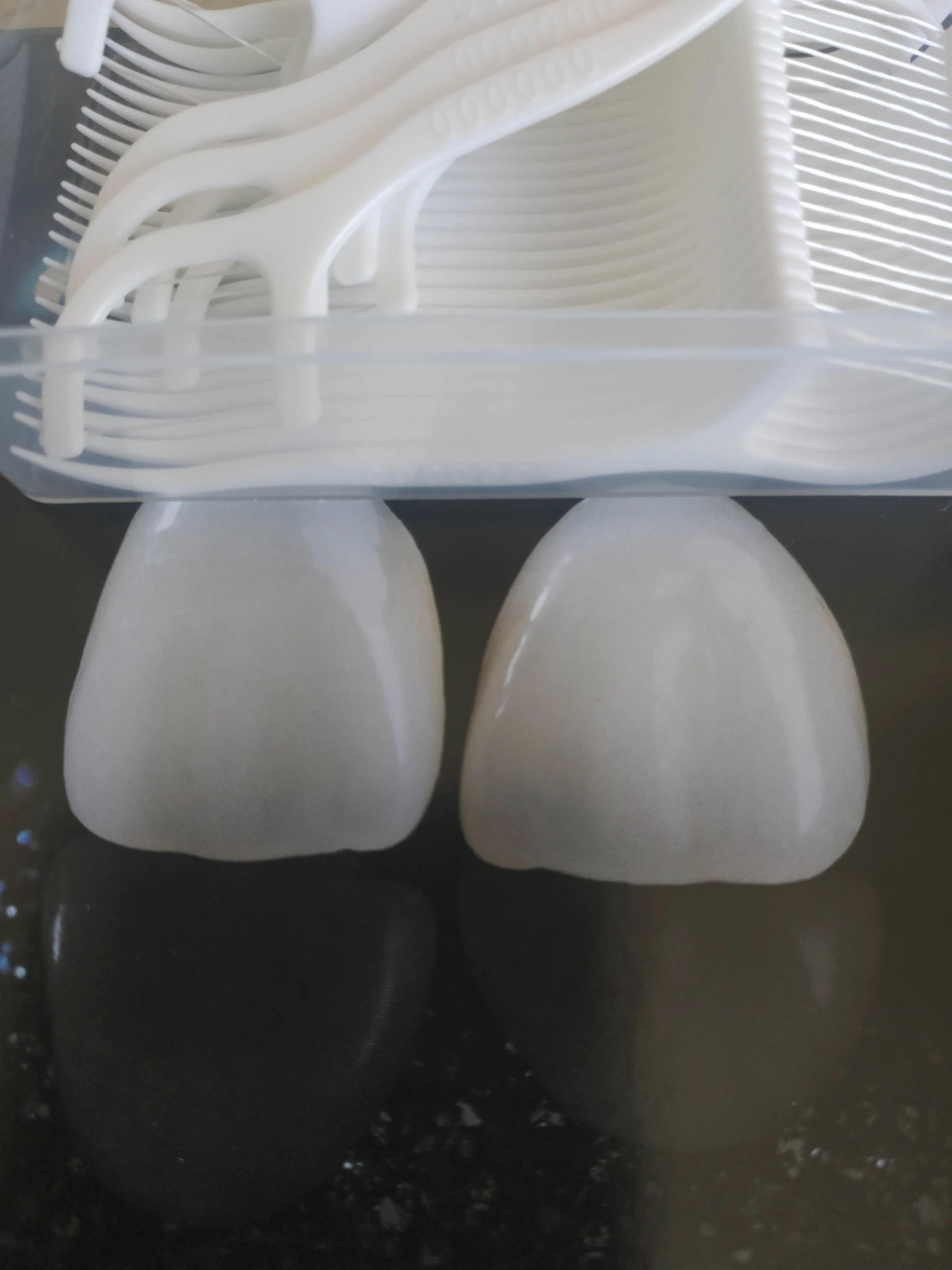 隔离期间如何熬过牙疼,隔离在家牙疼怎么办