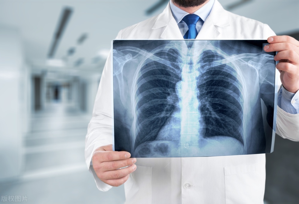 江苏46岁男子阳康后咳黑痰，去医院检查后，医生让其回家休息